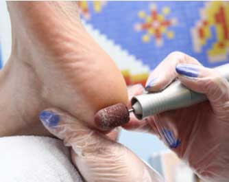 Podiatrist The Swift Verruca Clinic Gainsborough