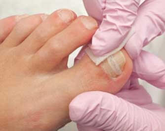 Podiatrist Beacon Chiropody & Podiatry Clinic Crowborough