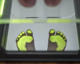 Podiatrist Solease Ltd Leicester